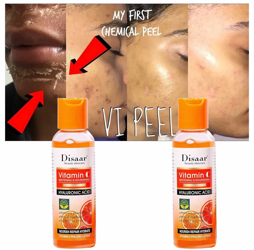 Peeling Disaar Éclatant à la Vitamine C – Peau Lumineuse & Hydratée