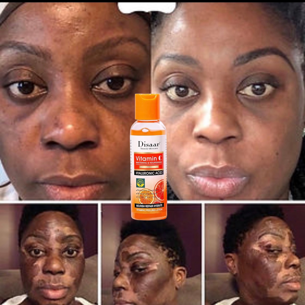 Peeling Disaar Éclatant à la Vitamine C – Peau Lumineuse & Hydratée