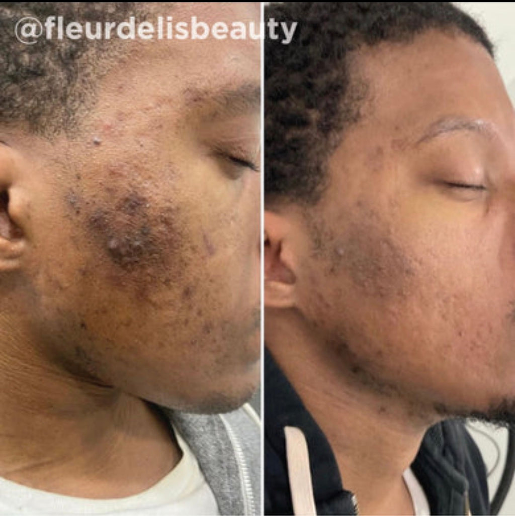 Peeling Disaar Éclatant à la Vitamine C – Peau Lumineuse & Hydratée